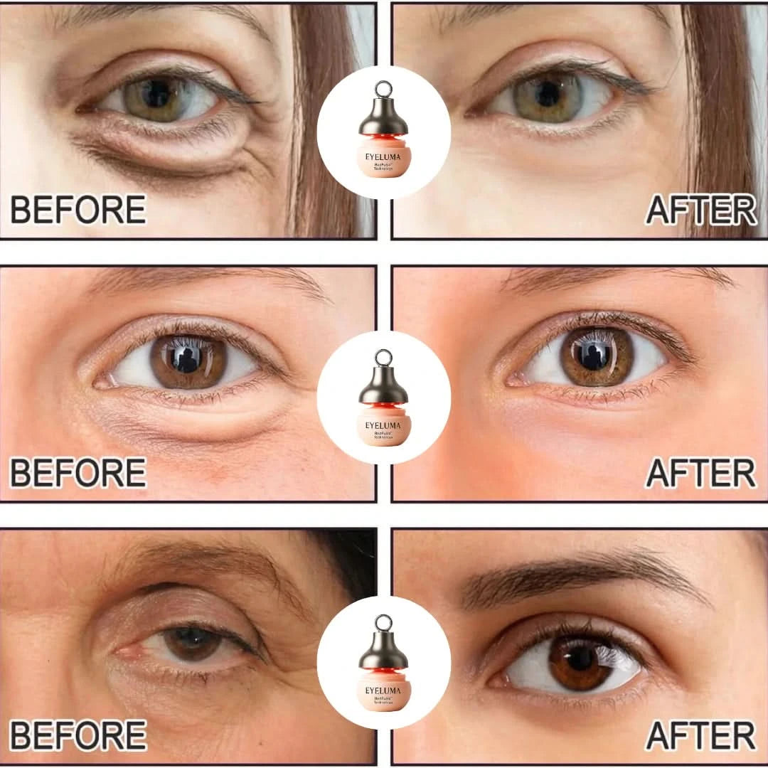 Eyeluma™ – The Korean Skincare Ritual That Awakens Your Eyes