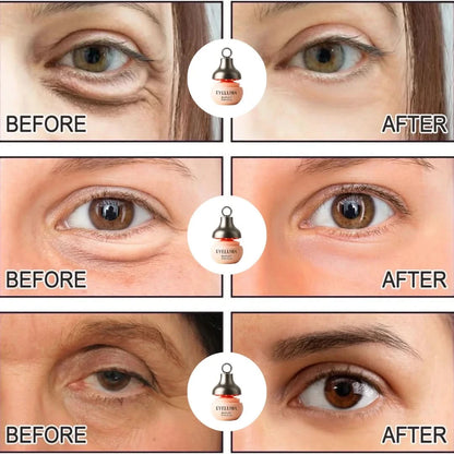 Eyeluma™ – The Korean Skincare Ritual That Awakens Your Eyes